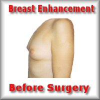 breast enhance before